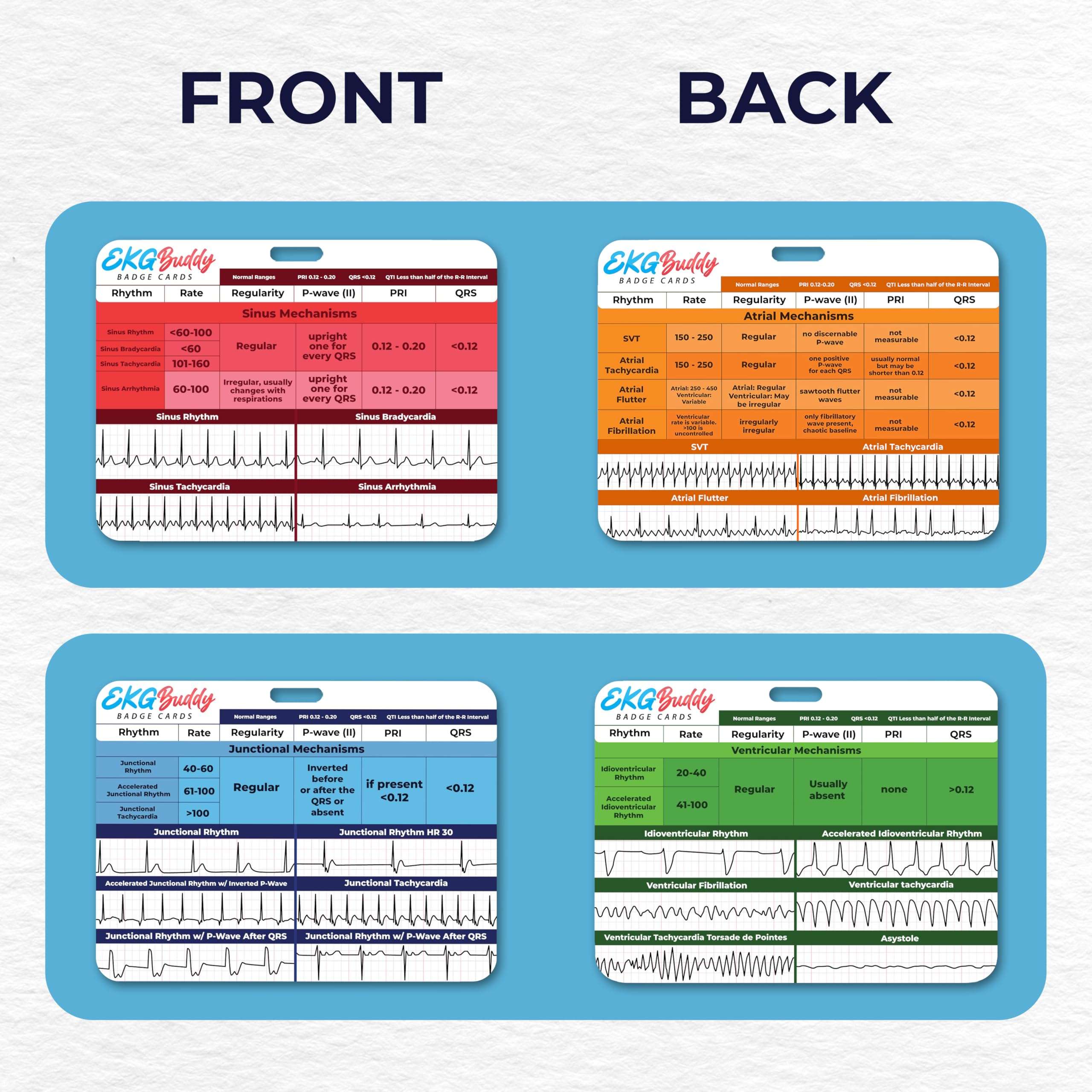 EKG Buddy's 5 Card EKG Interpretation Badge Set - Doubled Sided Nurse ECG Cards Guide Rhythm Cheat Sheet, EKG Telemetry Strips for ACLS Medical Cardiac Reference and Nursing Student Gift Accessories 2