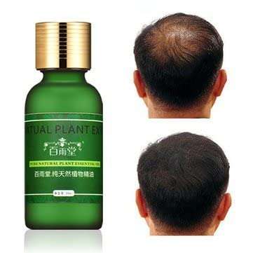 STORE99® Natural Plant Extract Rapid Hair Growth Essence Ginseng Ginger Herbal Pure 1