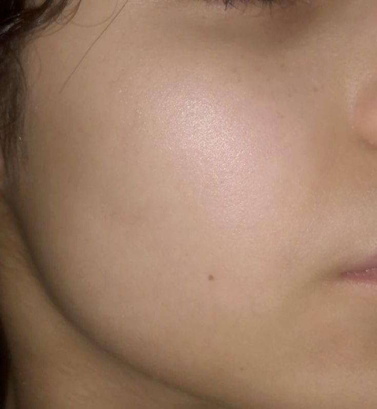 DR.VIGULS| BRIDAL MINI PAMPER KIT| APPLE CIDER VINEGAR 300ML | APPLE CIDER VINEGAR CONDITIONER 300ML| 2% HYALURONIC ACID FACE CLENANSER 200ML | ALOEVERA GEL 100GM | TAN REMOVAL SCRUB|GLUTATHIONE AND VIT-C BRIGHTING SERUM | HYALURONIC ACID SPF 60 PA+++ SUNSCREEN GLUTATHIONE SKIN WHITENING SOAP | 4