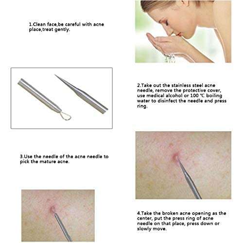 MAPPERZ Blackhead Acne Removal Needle Kit 4 Pcs Cleaning Tool Blemish Pimple Comedone for Women and Men Blackhead, Blemish, Whitehead Popping, Zit Removing for Risk Free Nose Face Skin with Case -PC1 6