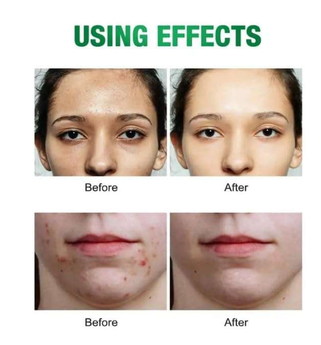 Earthly® Licorice Root Face Formula | Brightening | Dark Spot Remover | Anti-Aging & Glow Booster for All Skin Types | Natural Vegan Wrinkle Reducer | 30ML 5