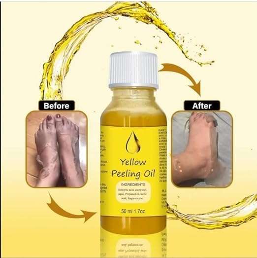 Unimoon Peeling Oil for Skin Exfoliation and Smooth Texture Brightening Formula for Body and Face Gentle Peeling Solution for Even Tone and Softness Home Beauty Application-PO-1 6