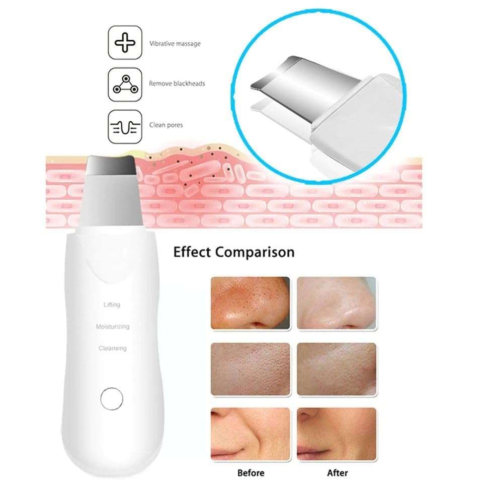 White heads and Blackhead Removal Tool | Ultrasonic Facial Kit Skin Scrubber Machine and Pores Cleanser with 3 Modes 4