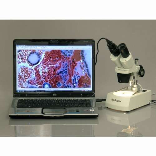 AmScope SE305R-P-LED Forward-Mounted Binocular Stereo Microscope, WF10x Eyepieces, 10X and 30X Magnification, 1X and 3X Objectives, Upper and Lower LED Lighting, Reversible Black/White Stage Plate, Pillar Stand, 120V or Battery-Powered 2