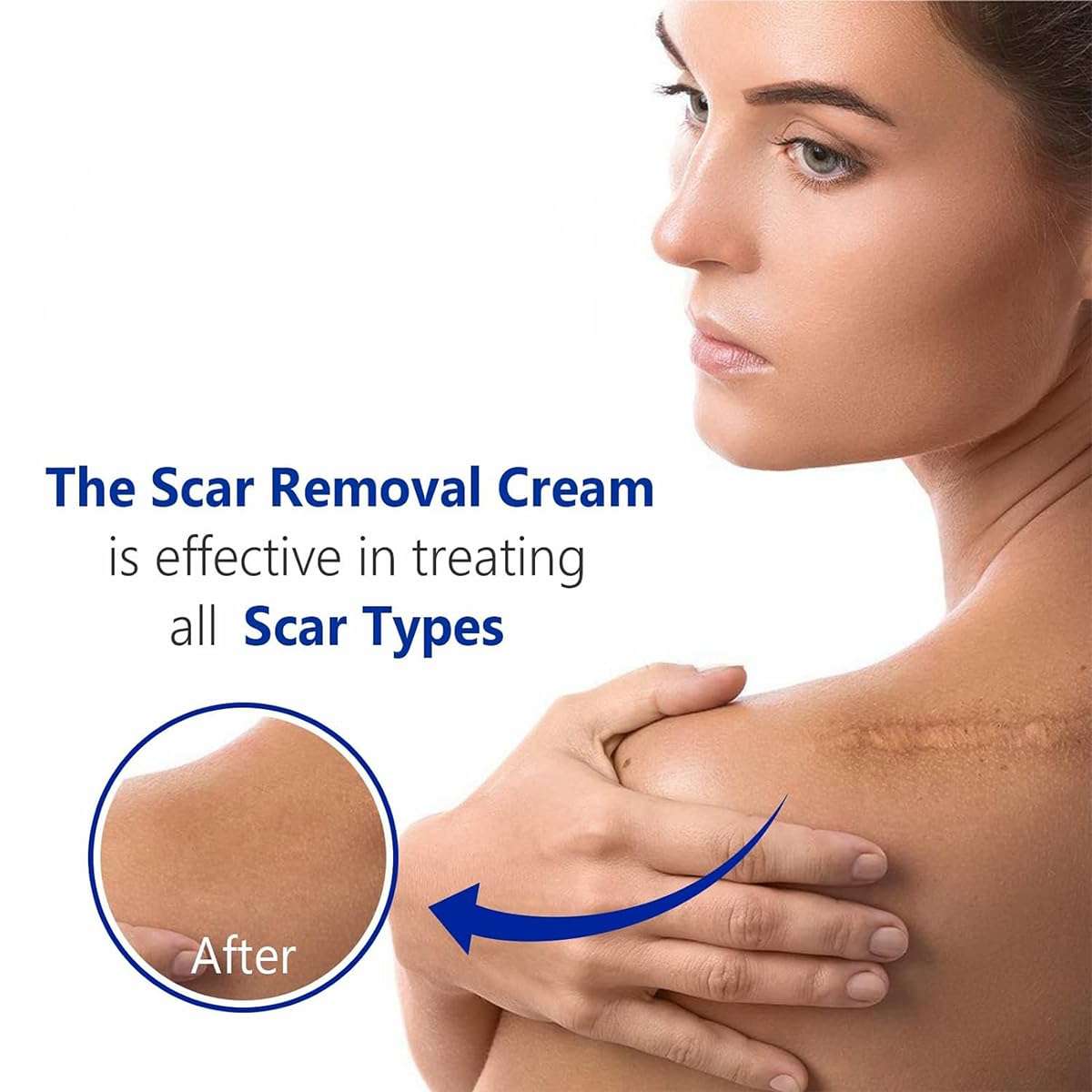 Advanced Scar Gel for Surgical Scars, Face, Body, Legs, Burns, Acne, C-Section, Stretch Marks, Keloids - Effective Scar Removal for Men and Women, Suitable for Old & New Scars (100% New -1 Bottle) 6