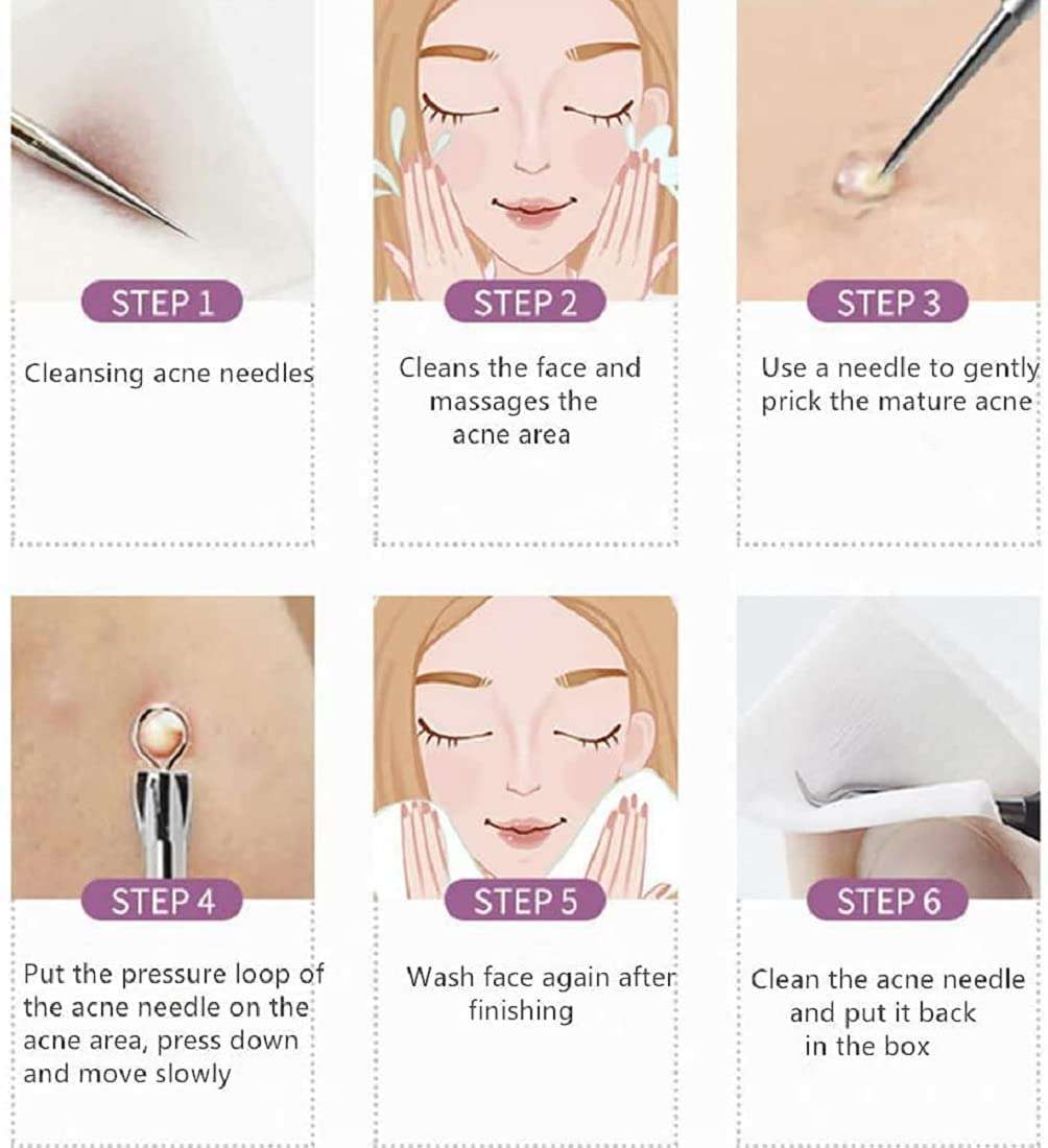 LA VENUST Stainless Steel Blackhead Whitehead Pimple Remover Acne Needles Set of 4 6