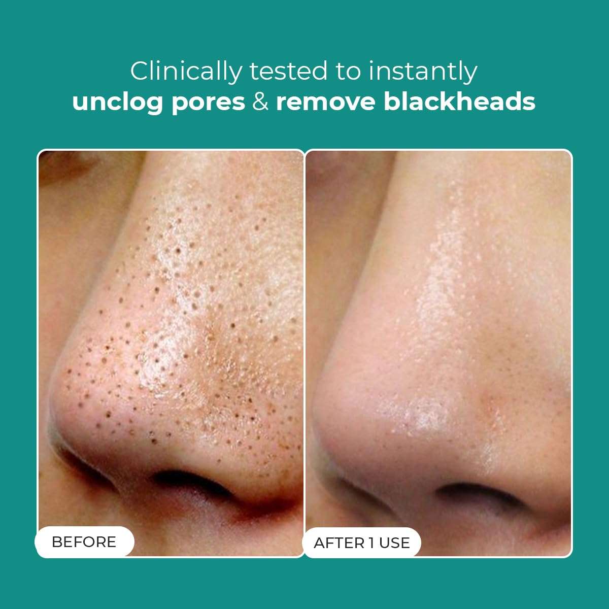 Conscious Chemist® Blackhead Melting Water | 130ml | Gentle Pore treatment with Succinic, Glycolic Acid & CICA Exosome | Unclogs Pores, Dissolves Blackheads & Smoothens Skin | Toner For Men & Women 3