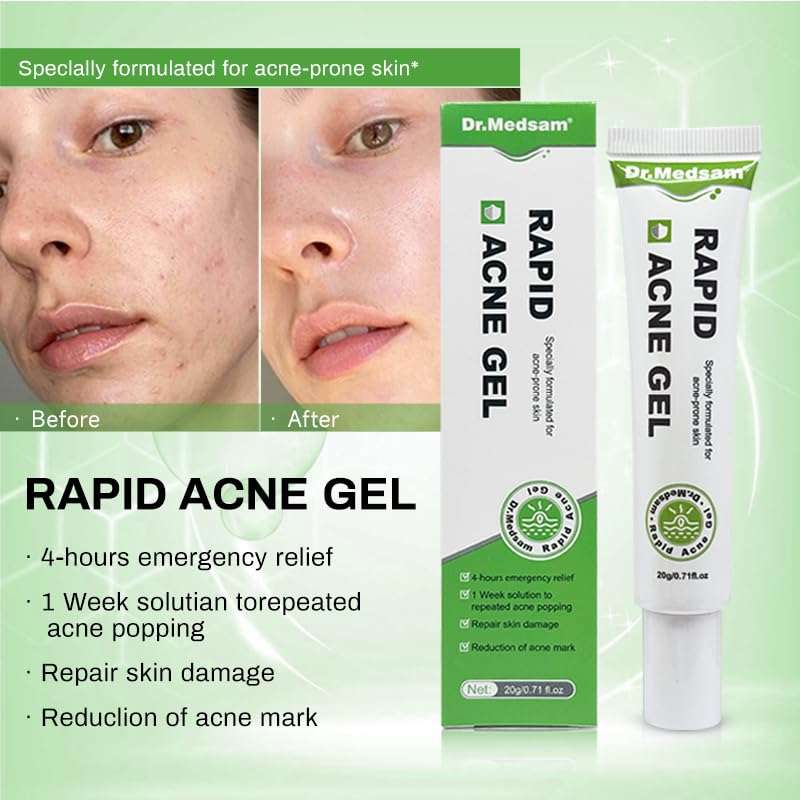 Dr.Medsam Rapid Ance Gel, Salicylic Acid Acne Treatment Acne Control Gel Inhibit Color Sink, Eliminate Acne Anti-inflammatory Sterilization Improve the Oil Pox Skin 20g/0.7Oz 6