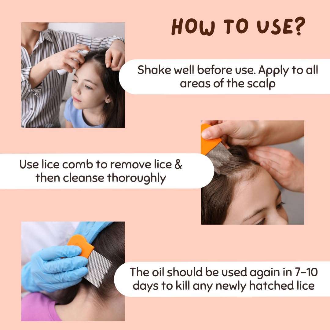 COCO CRUSH Ayurvedic Anti Lice Oil | Kills Lice, Eggs and Nits 100% Naturally In 20mins | Single Wash Treatment, Safe for Kids (100ml) 5