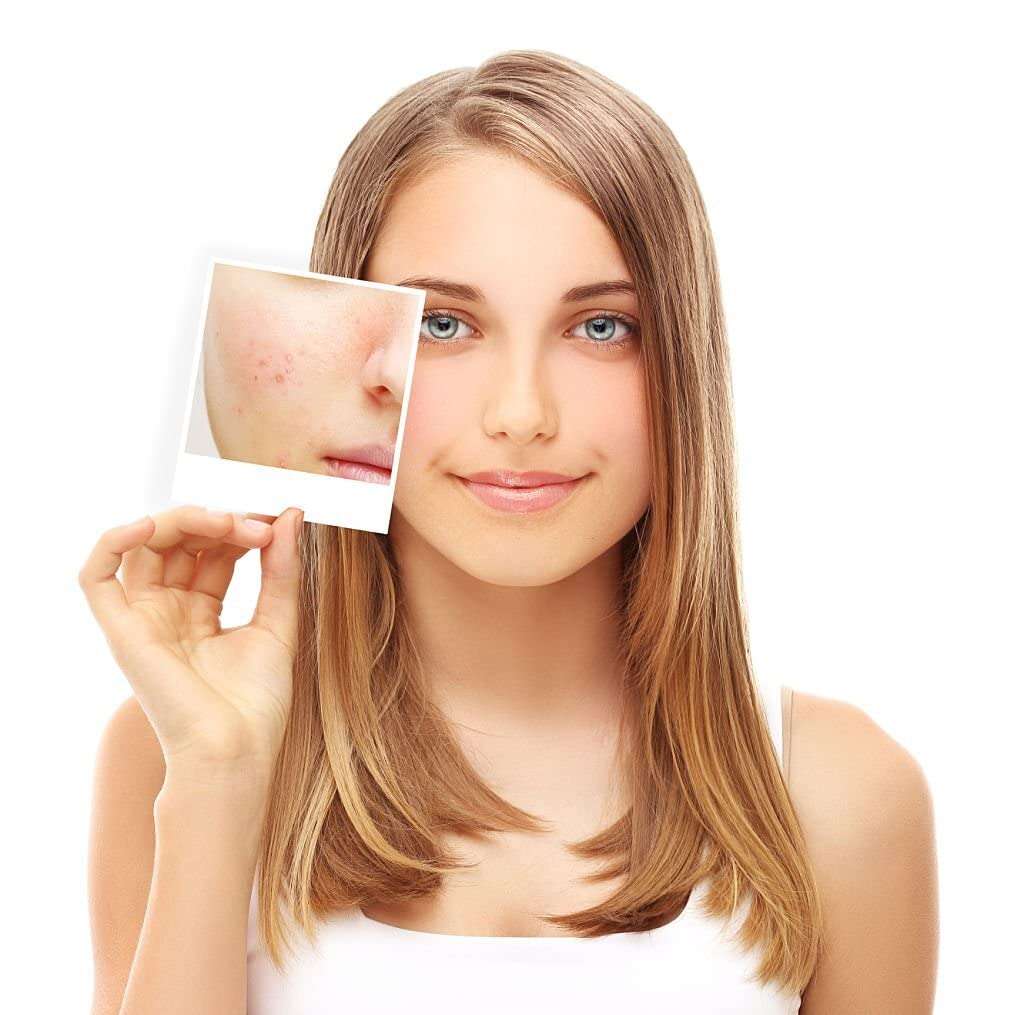 Original Kasthuri Manjal Powder and Rose Petal Powder Combo for Skin Whitening | Haldi | Wild Turmeric | Gulab | Dark Circle & Pimples | Pure | Organic | Herbal | Face Beauty | Glowing 6