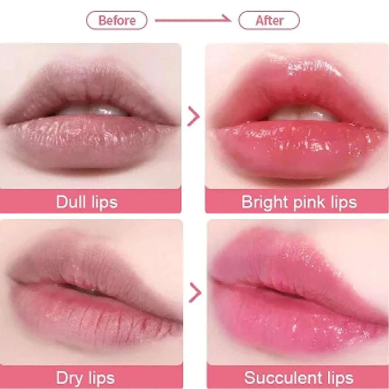 BALODI Probioderm Lip Balm, Probioderm Collagen Lip Balm, Probioderm Collagen Volume Lip Balm, Probioderm Lip Mask, Moisturizing, Hydrating, Exfoliating, Lightening Lip Lines 4