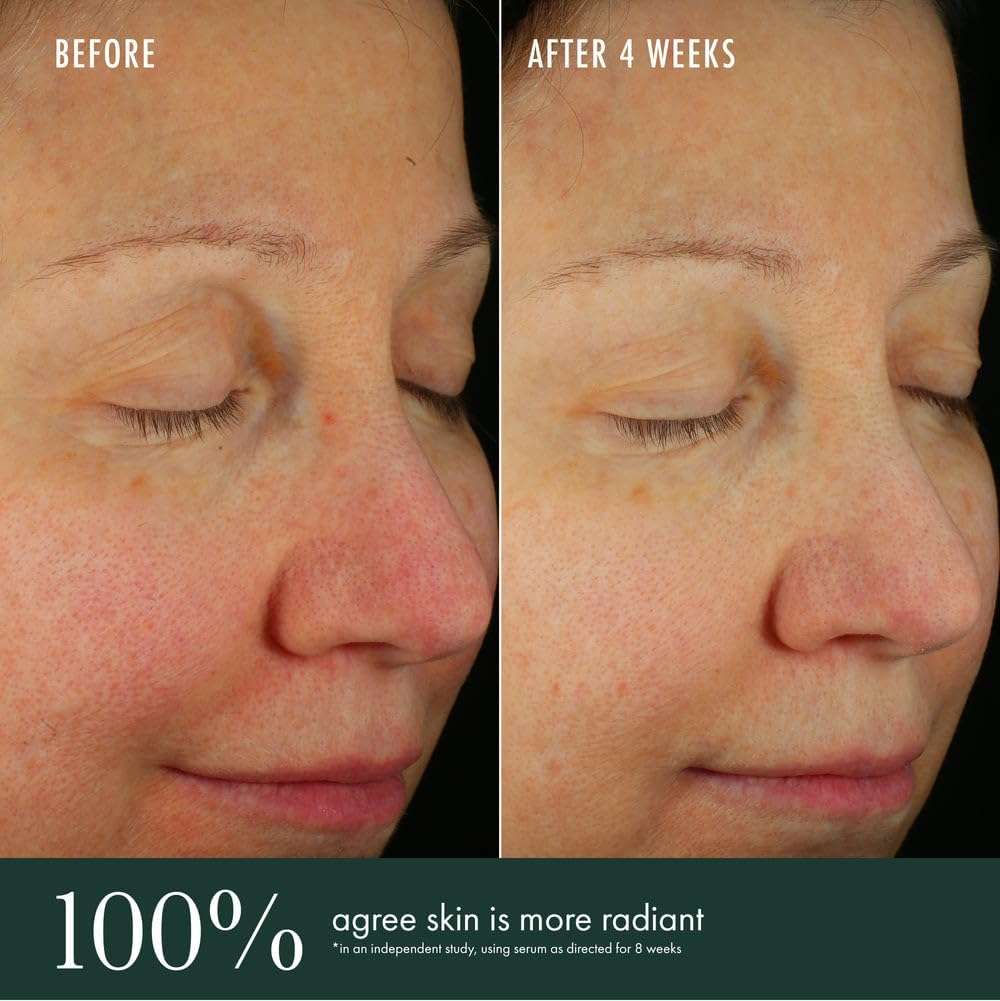 RéVive Brightening Serum - Skincare with Vitamin C, Niacinamide and Bio-Renewal Peptide - Evens Skin Tone, Refines Skin Texture and Reduces Wrinkles 4