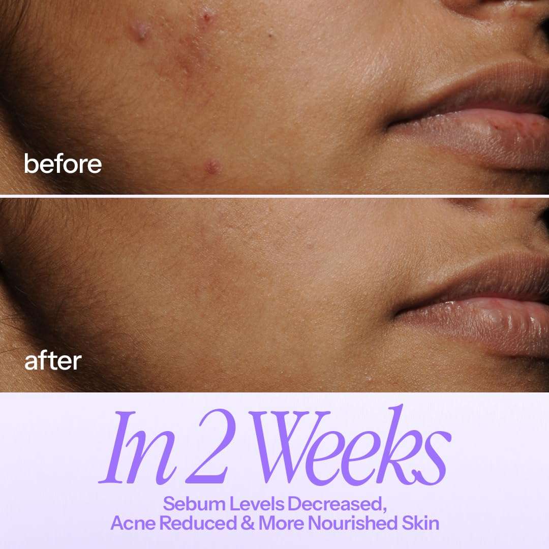 d'you inbalance Soothing Milky Tonic | Hydrating | Targets Inflamamtion | Soothing Irritation | Antioxidant Protection | Men and Women | 100 ml 6