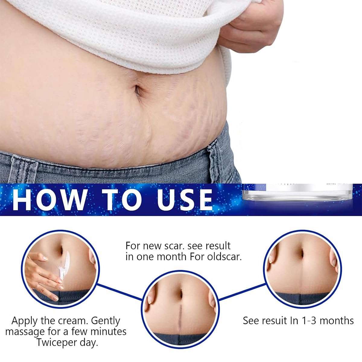 Advanced Scar Gel for Surgical Scars, Face, Body, Legs, Burns, Acne, C-Section, Stretch Marks, Keloids - Effective Scar Removal for Men and Women, Suitable for Old & New Scars (100% New -1 Bottle) 5