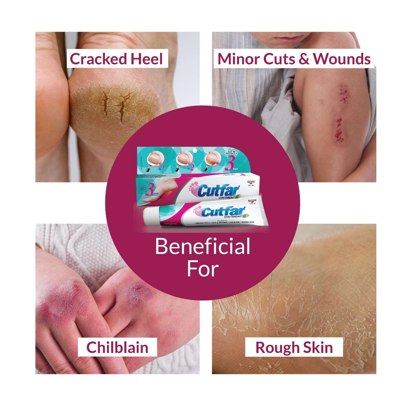 Ban Labs Cutfar Ointment - 25G (Pack of 2) | Cracked Heels repair | Chilblain Cream | foot cream |Cuts & Wounds |Rough Skin| For Cracked & Painful Heels 5