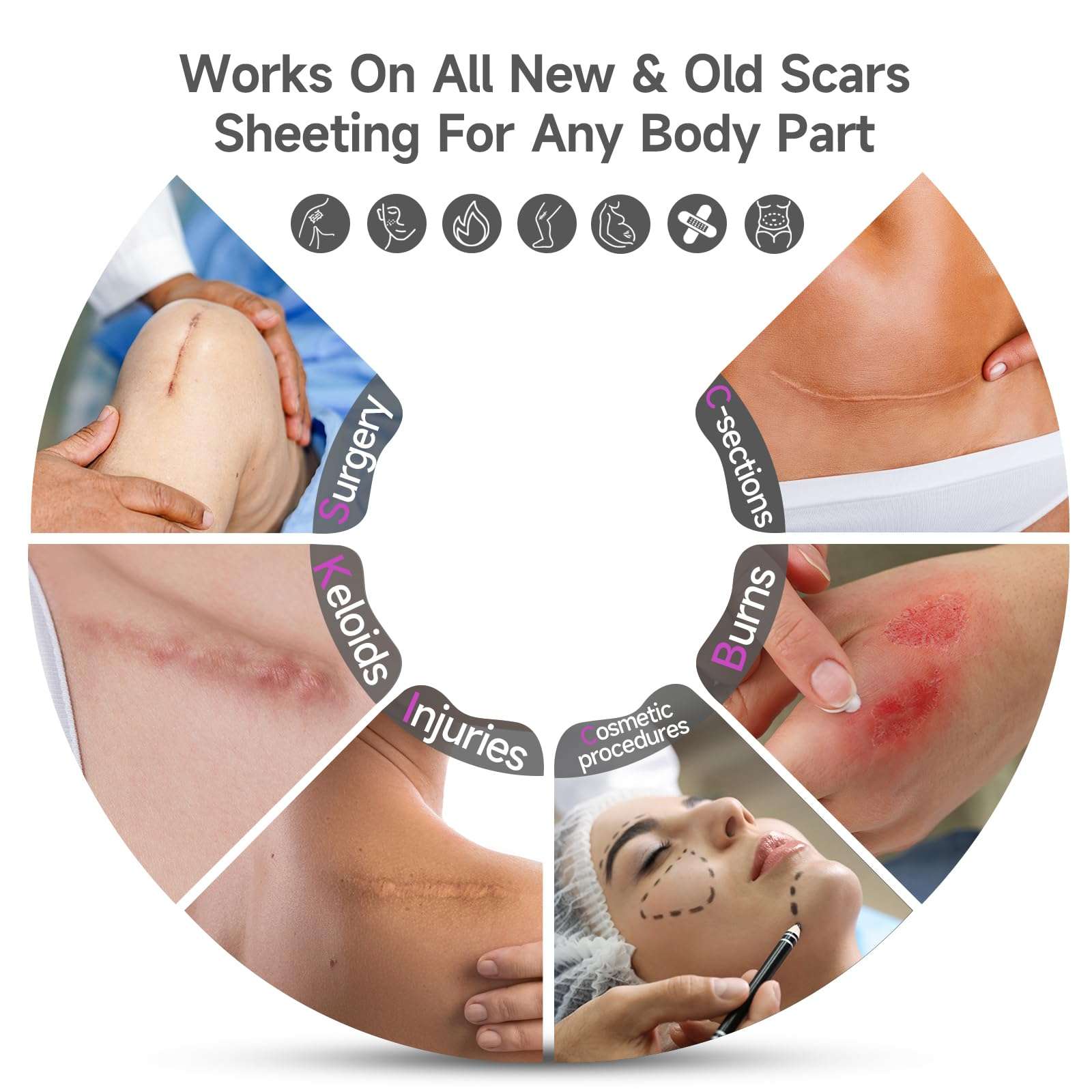 Advanced Scar Cream Silicone Scar Gel Scar Removal Cream for Face, Body, Surgical, C-section, Stretch Marks, Acne, Injury, Burns, Keloids, Old and New Scars 1.7 oz(50g) 6