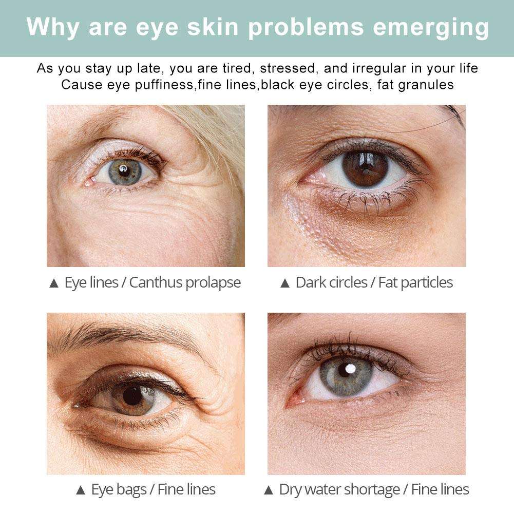 Rapid Reduction Eye Cream,Under-Eye Bags Treatment,Instant Results Depuffing Eye Cream,Fights Wrinkles and Fine Lines,Reduces Appearance of Dark Circles 6