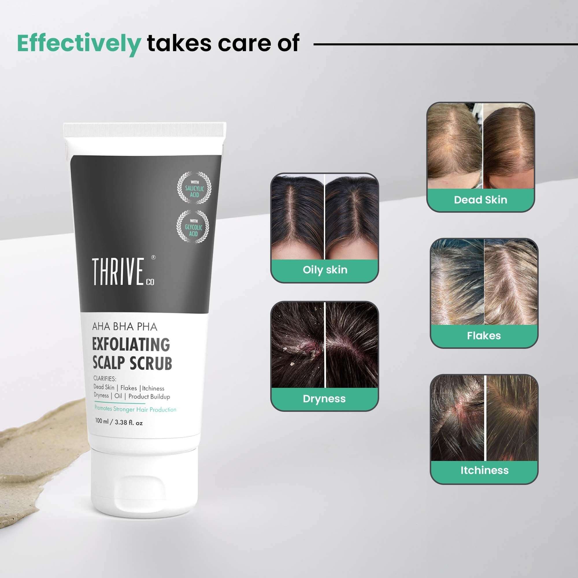 ThriveCo AHA BHA PHA Exfoliating Scalp Scrub | Clears Dandruff, Dead Skin, Oil & Product Buildup And Promotes Hair Growth | Acts On Dry, Flaky & Itchy Scalp | For Men & Women | 100ml 4