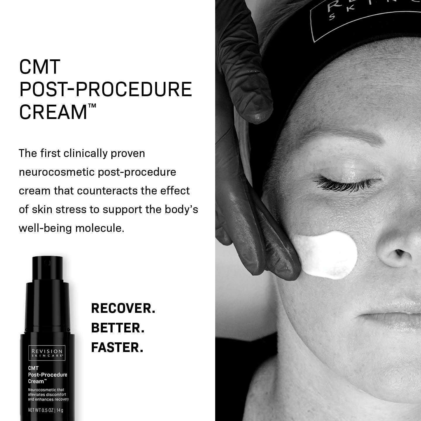 Revision Skincare CMT Post-Procedure Cream™, Clinically Tested Post-Procedure Skin Care, Sensitive Skin Moisturizer for Microneedling, Irritated Skin, Supports Recovery & Restores Skin Barrier, 2 oz 3