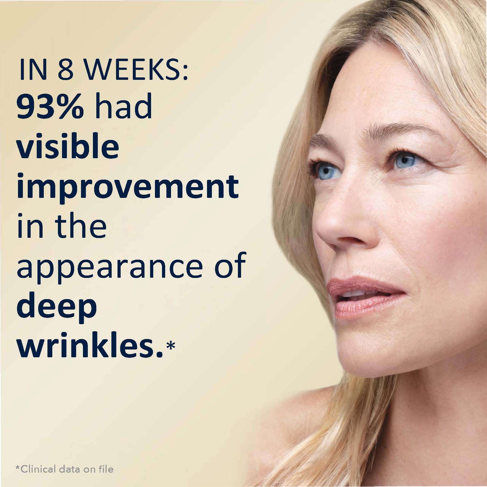 RoC Retinol Correxion Deep Wrinkle Night Cream,30 ml 3