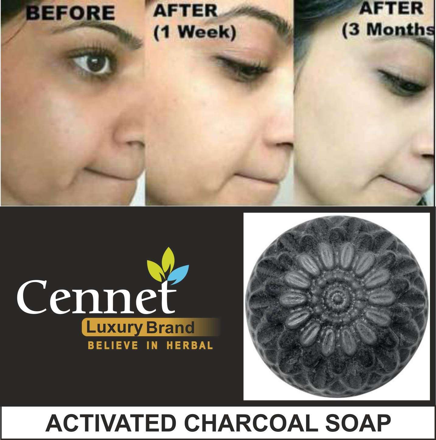 Cennet Activated Charcoal Soap For Women Skin Whitening, Acne, Blackheads, Anti Wrinkle, Pimple Skin Care Soap.( Pack Of 4 ) 4 X 100 g. 3