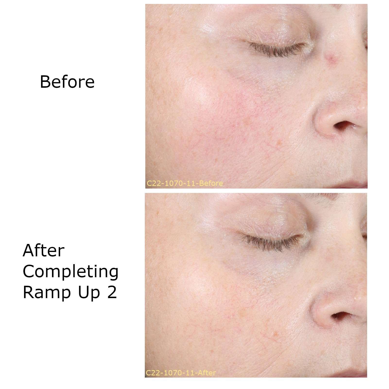 OPULUS Beauty Labs Hydrate & Soothe Beauty Collection Gift Bundle/Starter Kit, Activator with 0.05% Retinol Cream, Ramp-Up Regimen 2 & RHR Overnight Mask, Skin Care Routine, For All Skin Type 3