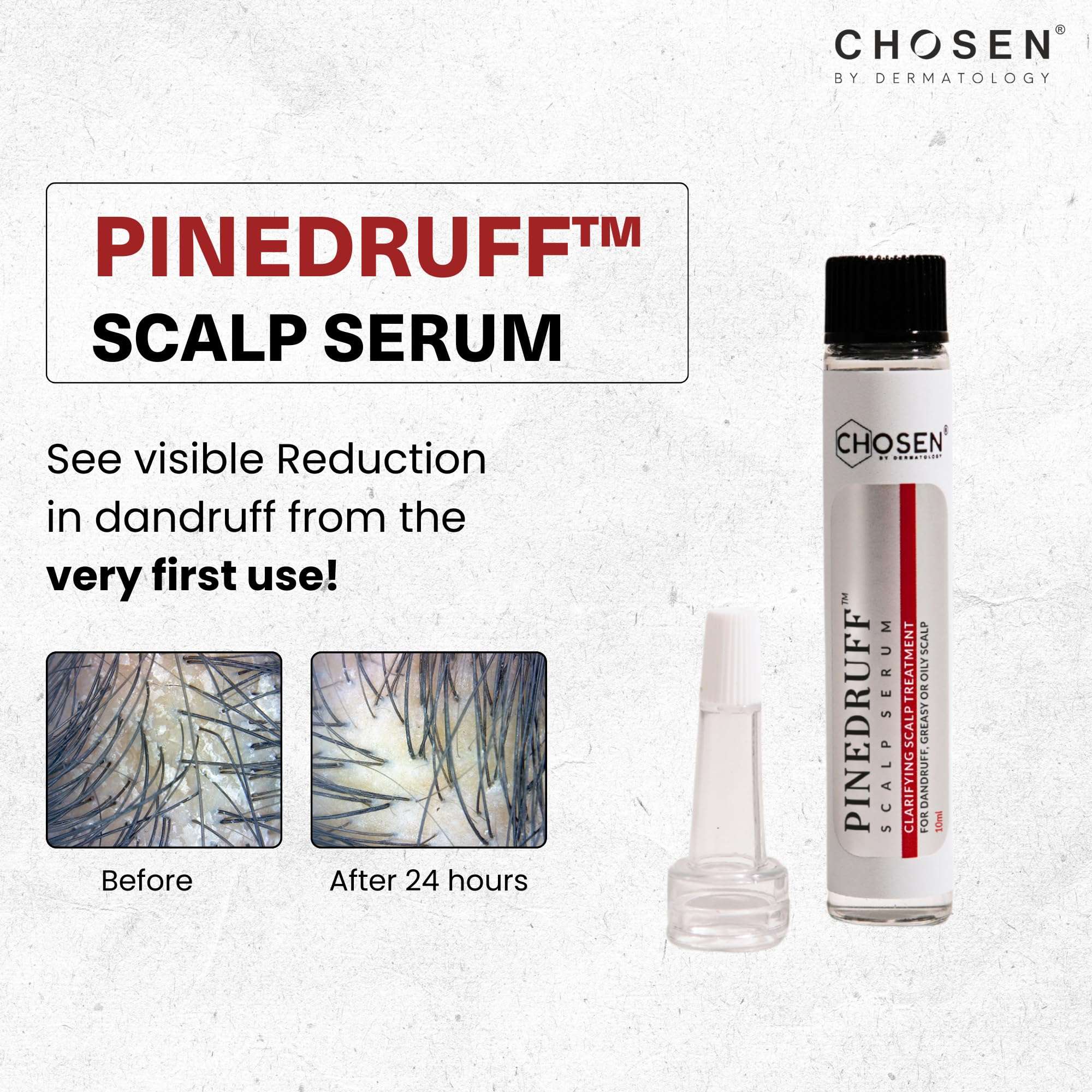 CHOSEN® Pinedruff® Anti-Dandruff Serum | Reduces Dandruff, Gentle, Hydrating & Safe | 10ML 6