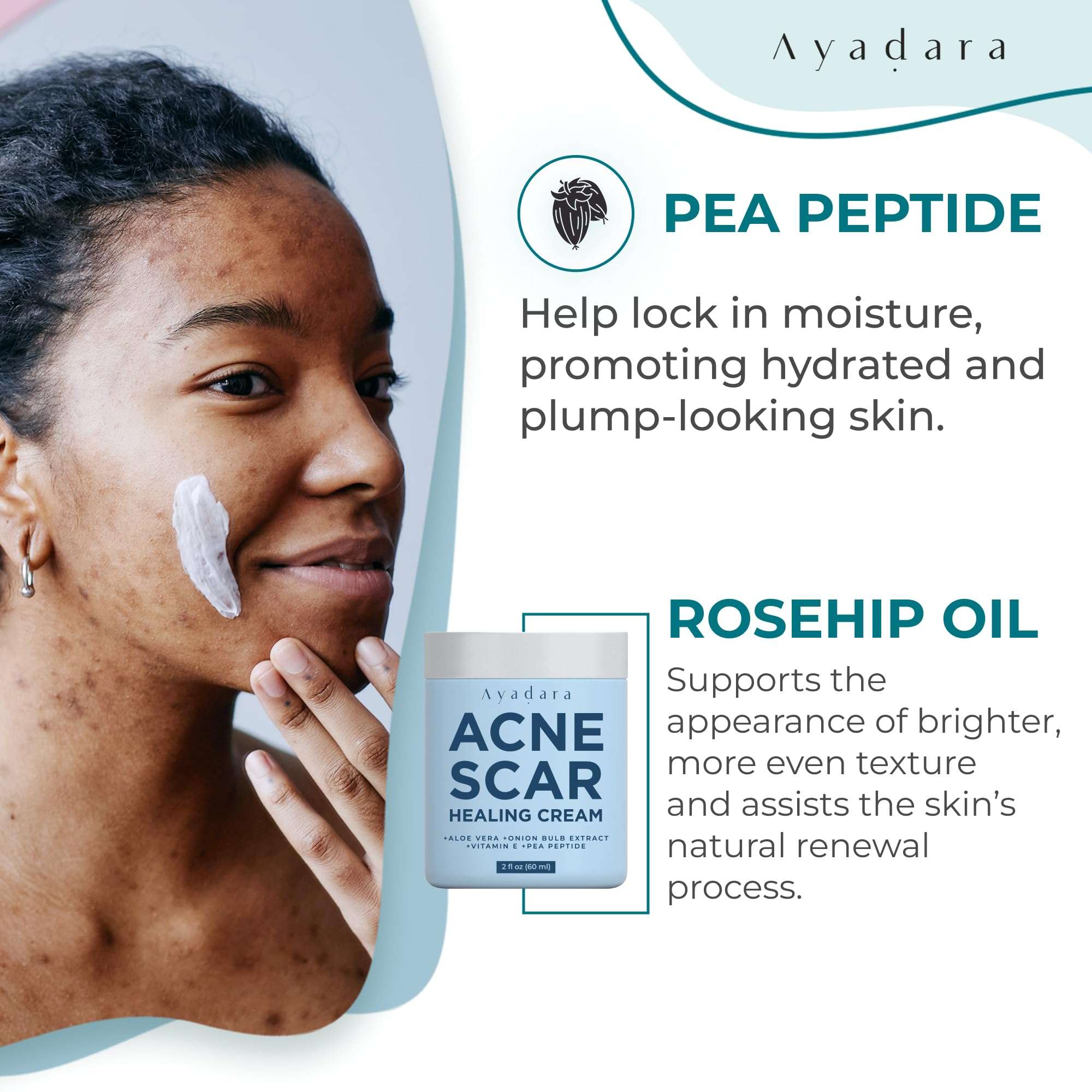 AYADARA Acne Scar Healing Cream, 2 fl oz, Acne Treatment for Face, Stretch Marks, Body Scars, Acne Scar Removal Cream for Body, Acne Remover for Cuts and Burns, For All Skin Types, 200+ Uses 6