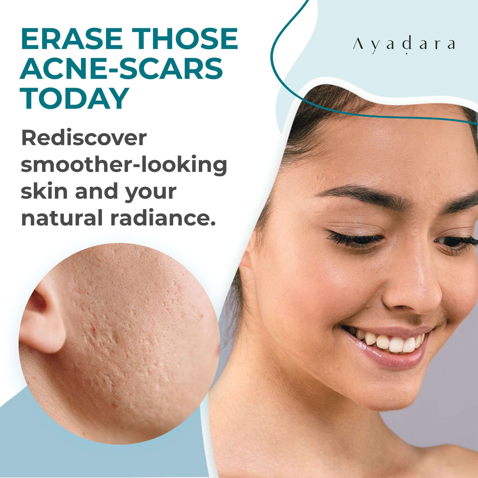 AYADARA Acne Scar Healing Cream, 2 fl oz, Acne Treatment for Face, Stretch Marks, Body Scars, Acne Scar Removal Cream for Body, Acne Remover for Cuts and Burns, For All Skin Types, 200+ Uses 2