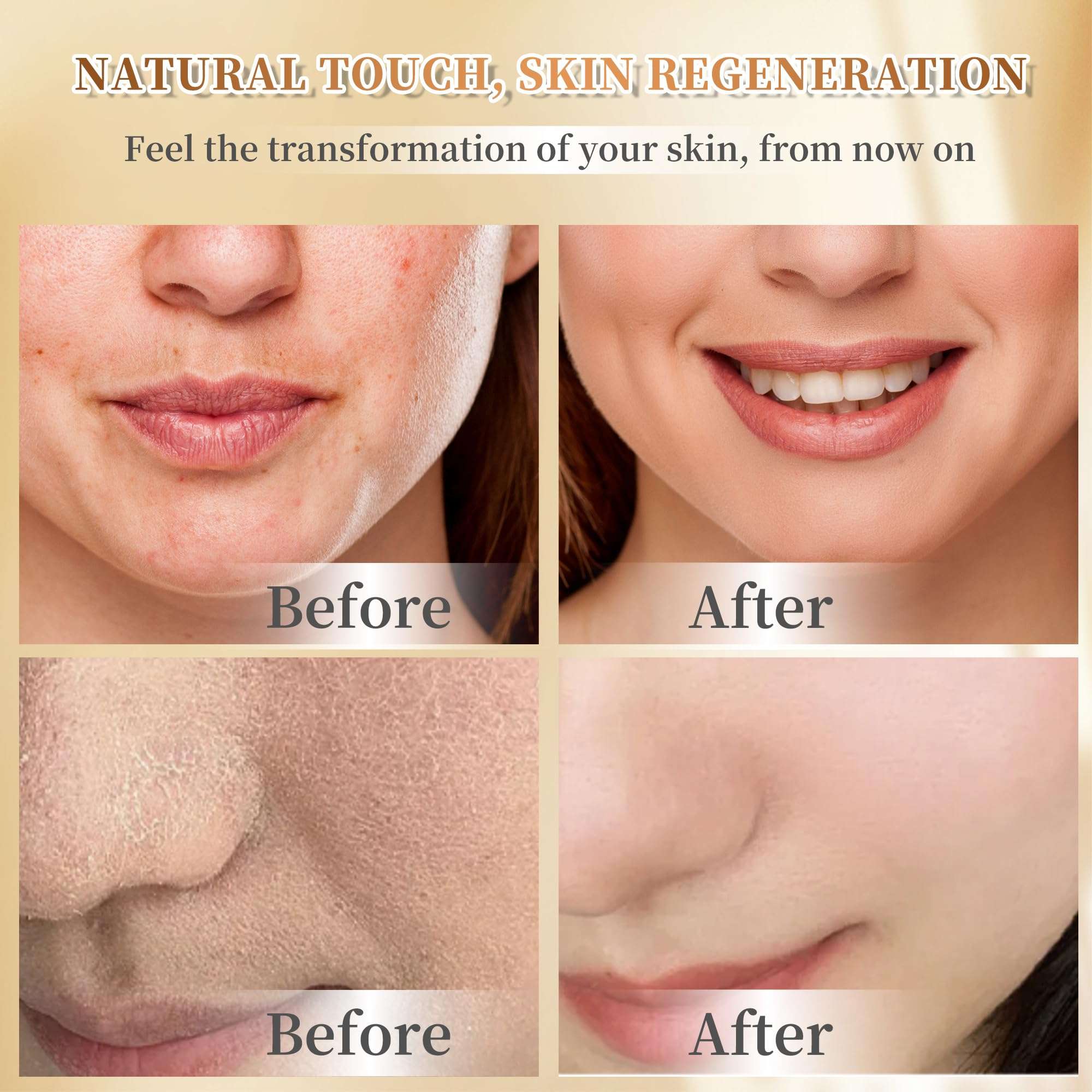 Beef Tallow for Skin, Organic Grass-Fed Beef Tallow Balm with Raw Honey - Whipped Moisturizer for Face & Body - All-Natural Skin Care for Soft, Hydrated Skin 4OZ 5