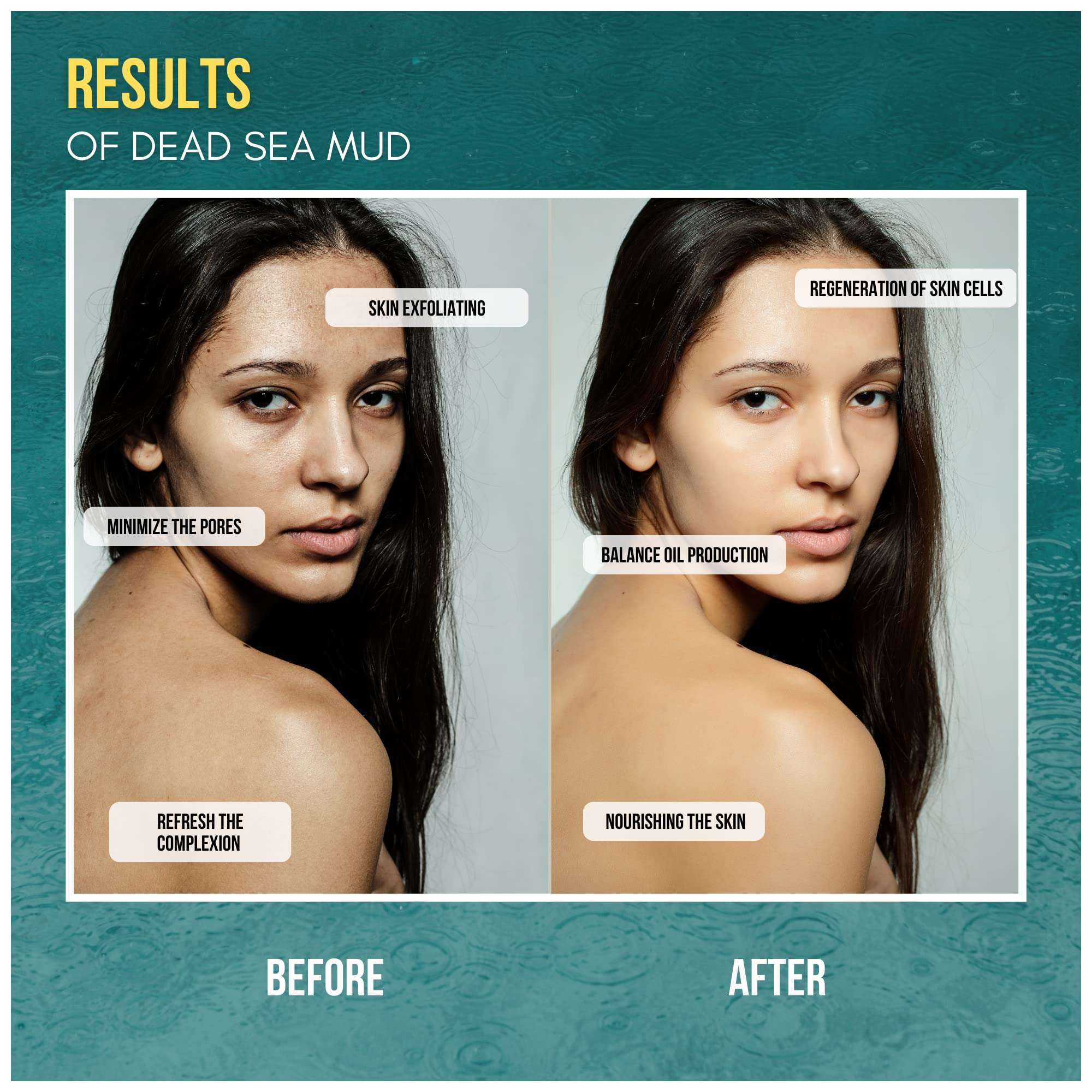 Beauty Secret Dead Sea Mud Mask For Face And Body, Natural Pore Reducer And Minimizer To Help Treat Acne, Blackheads And Oily Skin 5