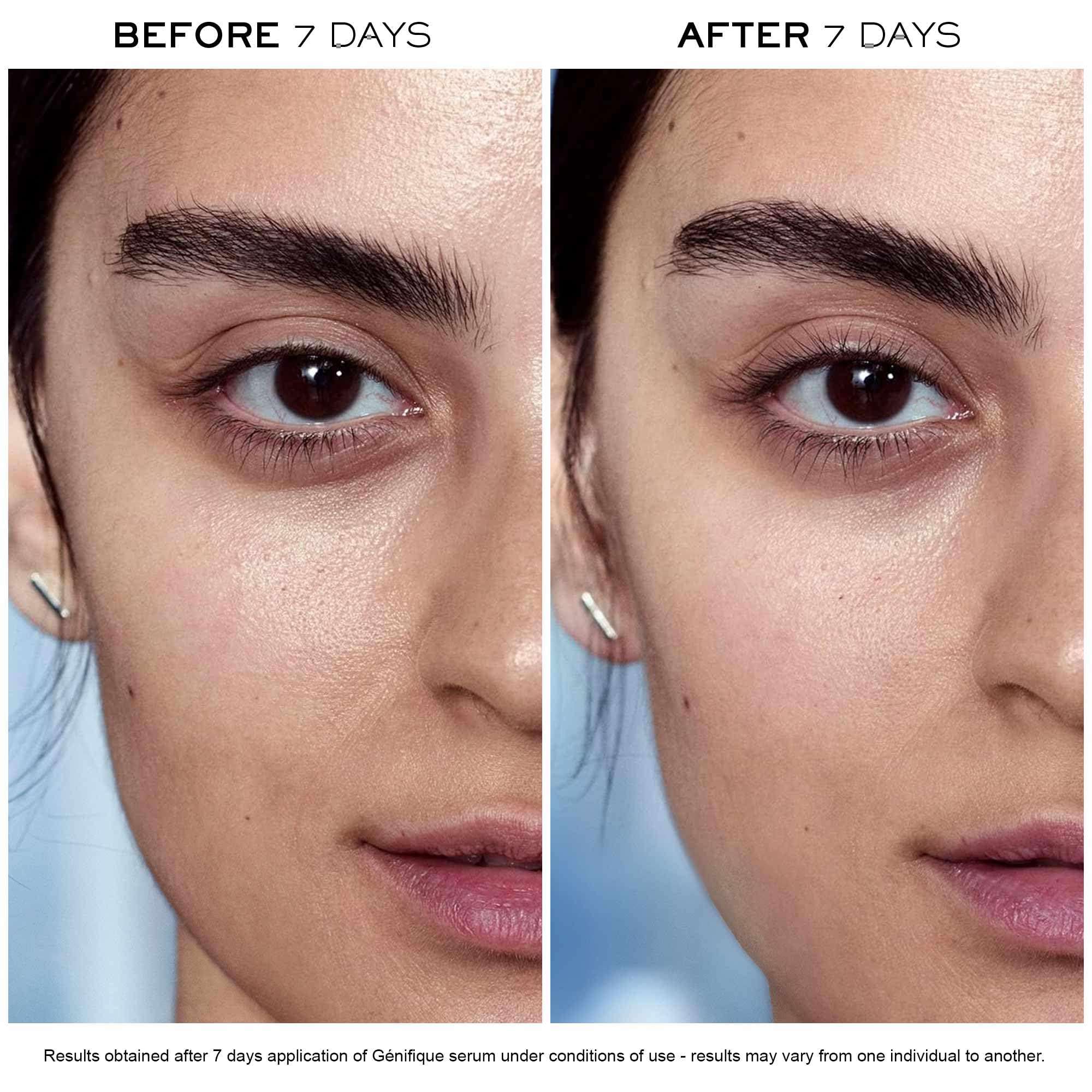 Lancôme Advanced Génifique Radiance Boosting Anti-Aging Face Serum - Visibly Hydrates & Plumps Skin - with Bifidus Prebiotic, Hyaluronic Acid & Vitamin Cg, 3.8 Fl Oz 6