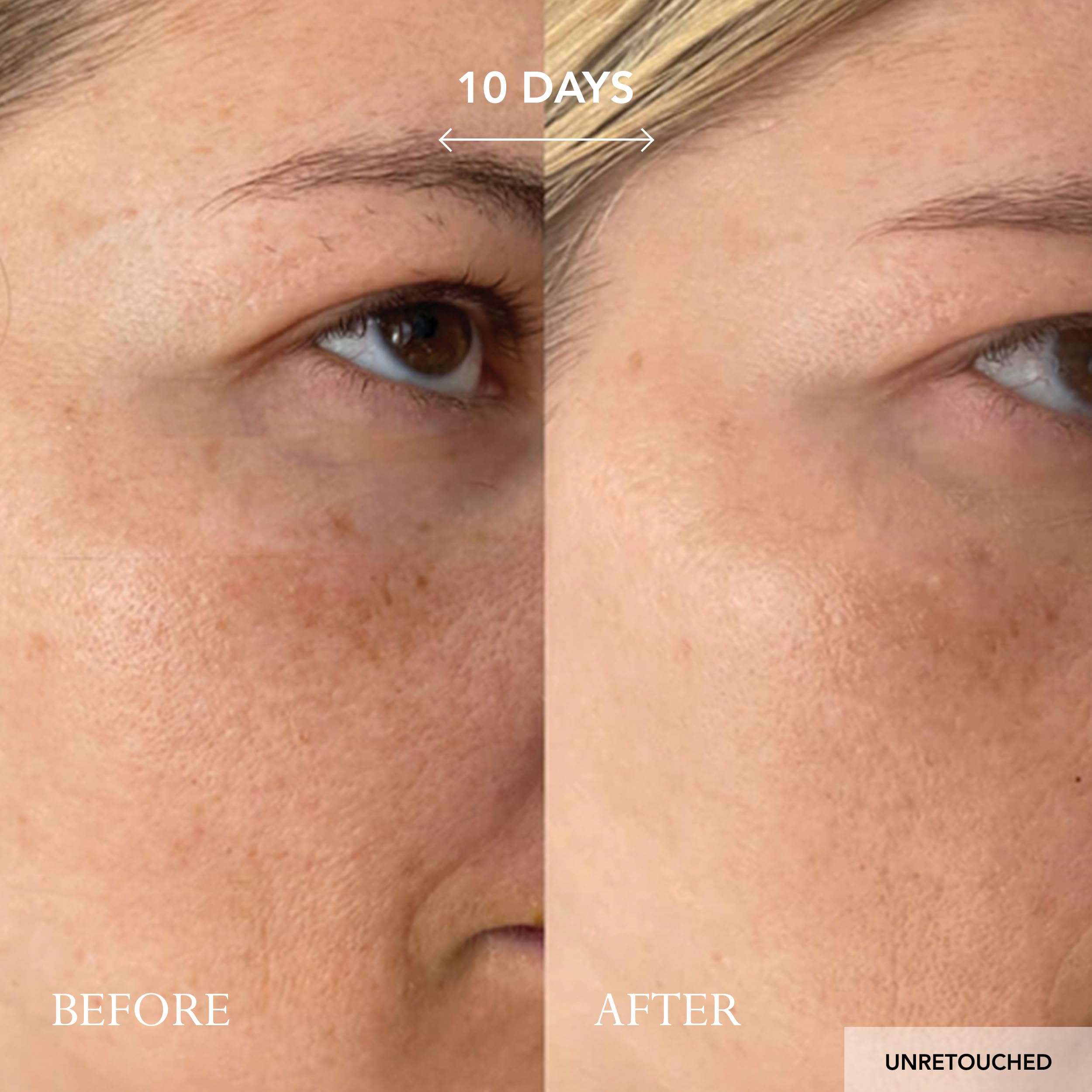 KAT BURKI 15% Stabilized Vitamin C Intensive Face Cream. Radiance-Boosting Moisturizer for Glowing & More Firm Skin, 3.4 fl.oz. 6