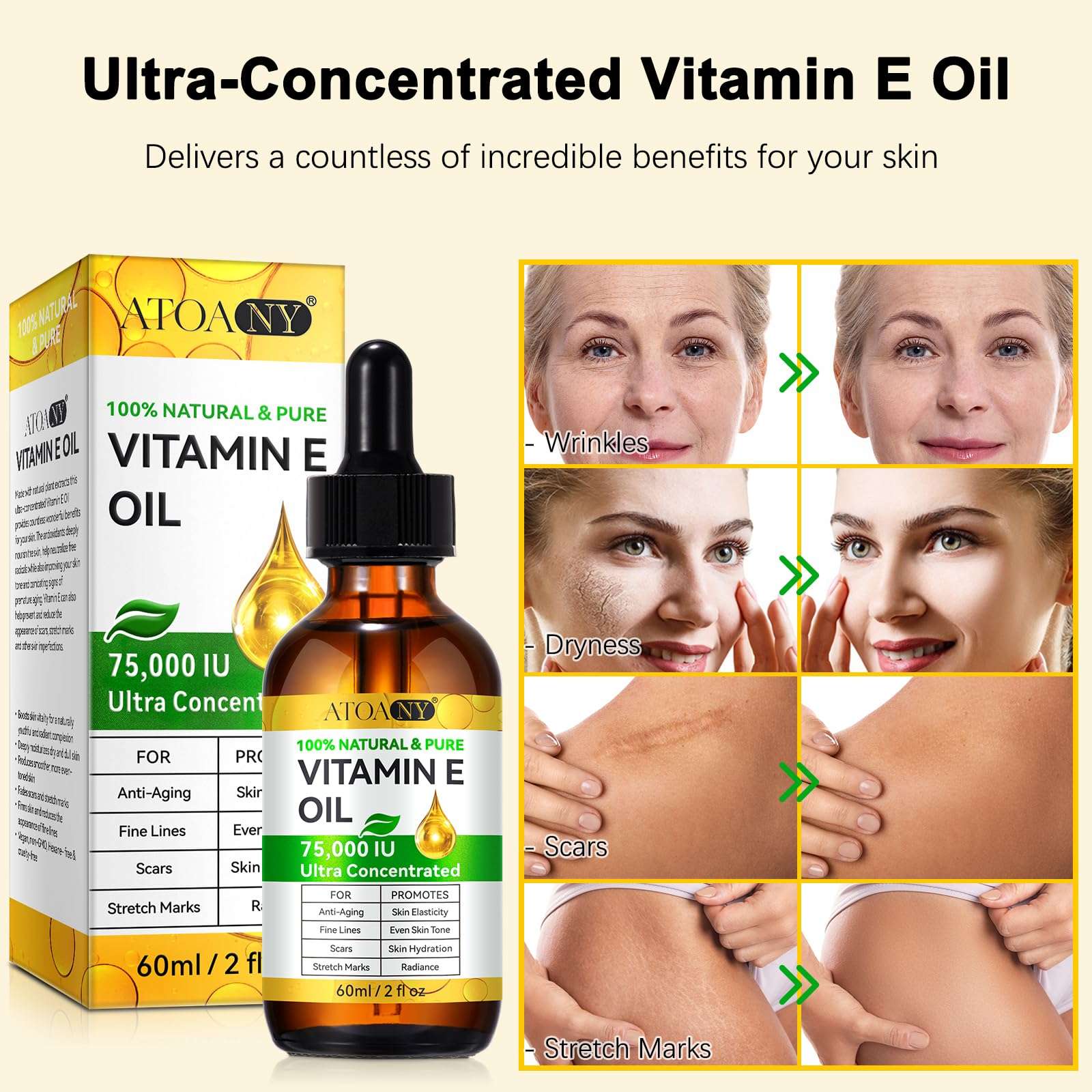 FlameBeauty Vitamin E Oil 75,000 IU - Pure & Natural Skin & Hair Care - Moisturizing for Face, Body, Sars and Scalp 2 Fl Oz 6