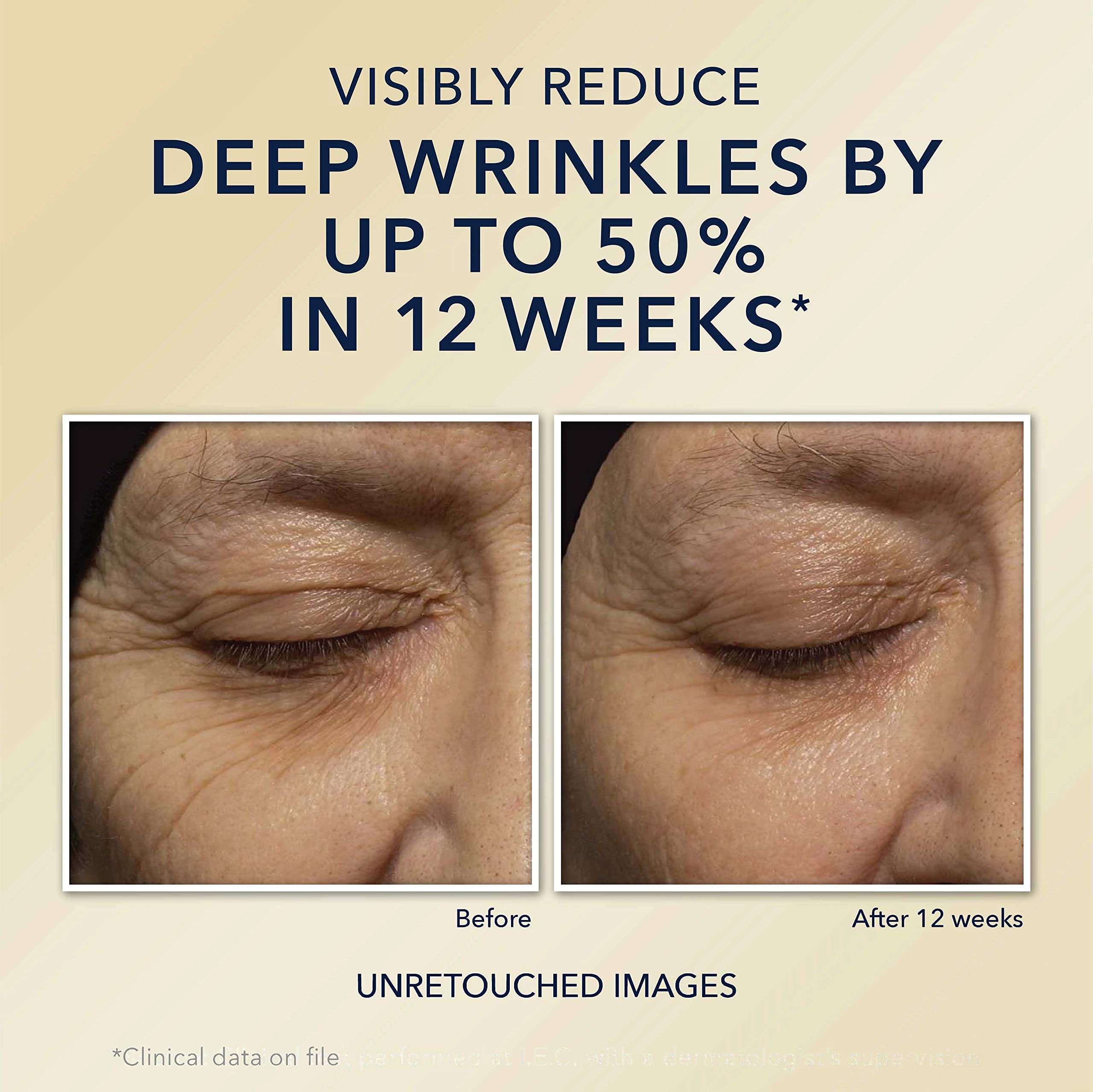 RoC Retinol Correxion Deep Wrinkle Night Cream,30 ml 4