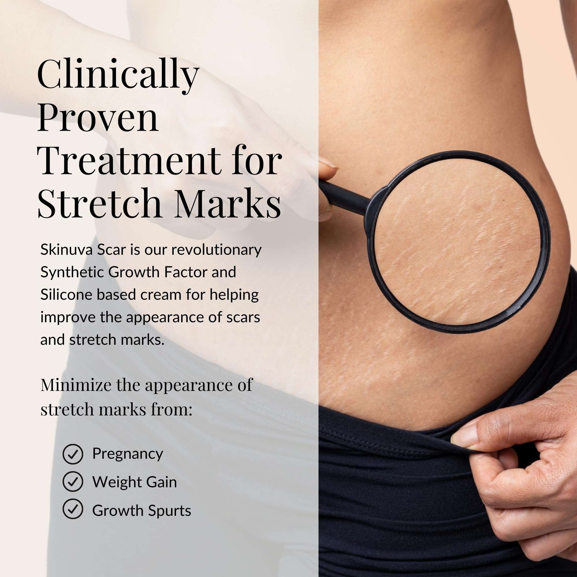 Skinuva® Next Generation Scar Cream - Stretch Mark Cream Made with Growth Factors, Hyaluronic Acid & Vitamin C for Intense Stretch Mark Removal (2.5 oz) 5