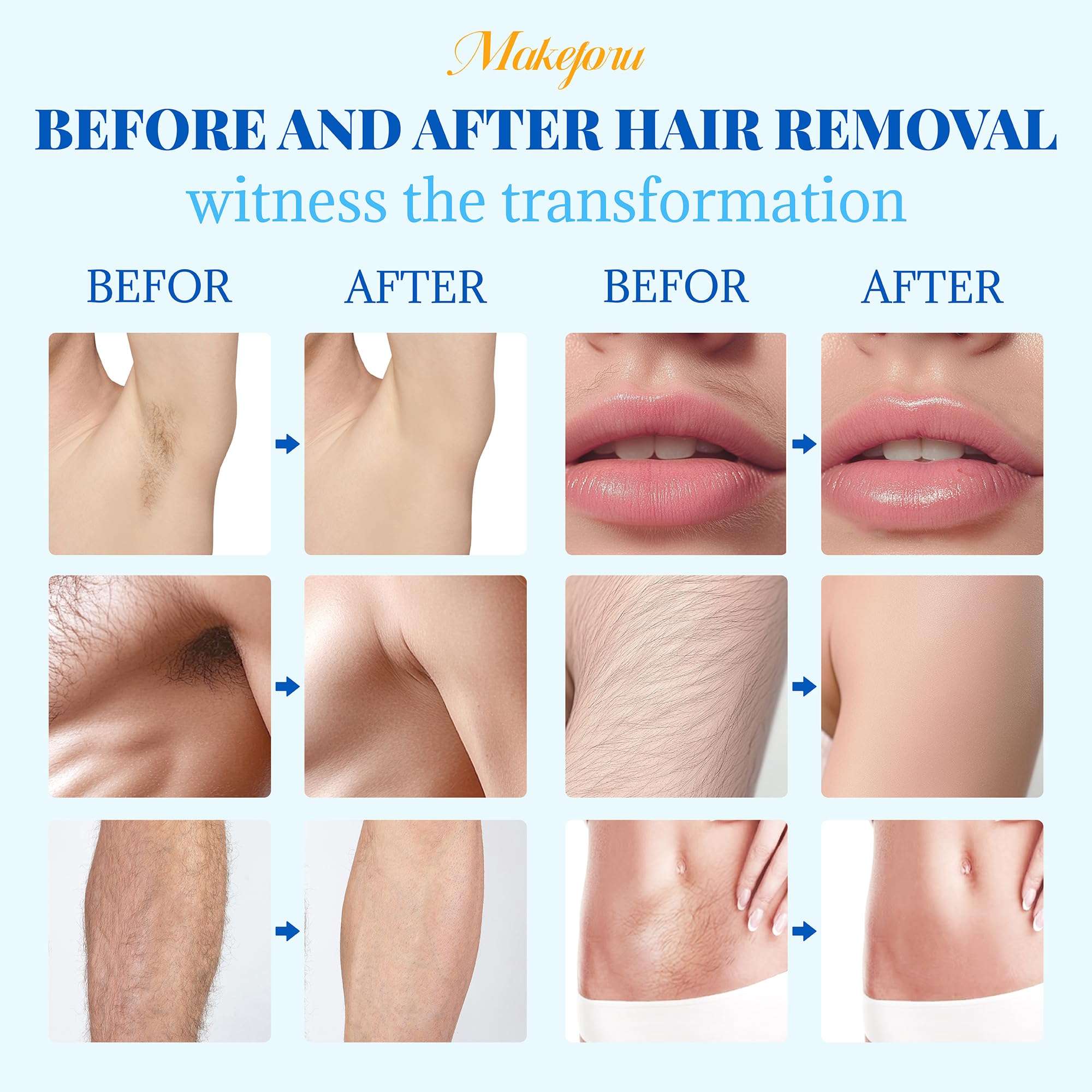 Hair Removal Wax Beads 2.2lb (1000g), Hard Wax Beads for Whole Body, Painless Hair Removal Wax Bead Set for Women and Men, 10 Flavours, Contains 20 Wax Sticks 5