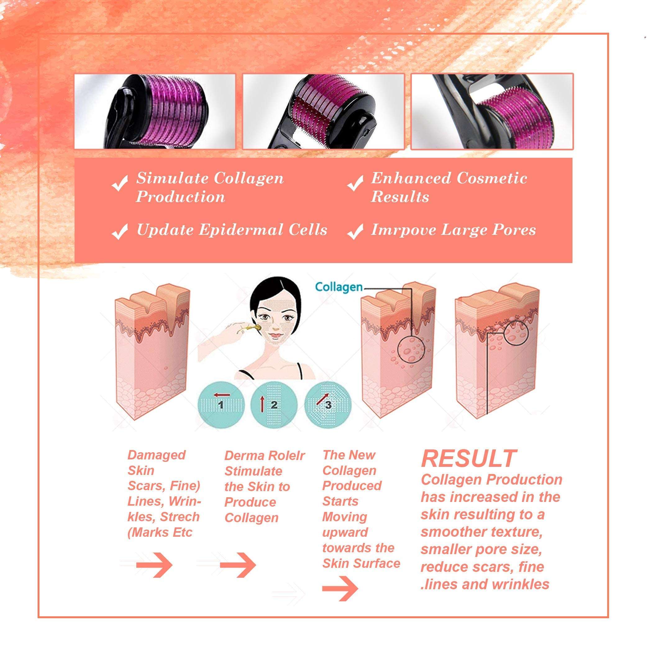 Epyz Derma Roller with 540 Titanium Alloy Needles (1.5mm, Pink) 6