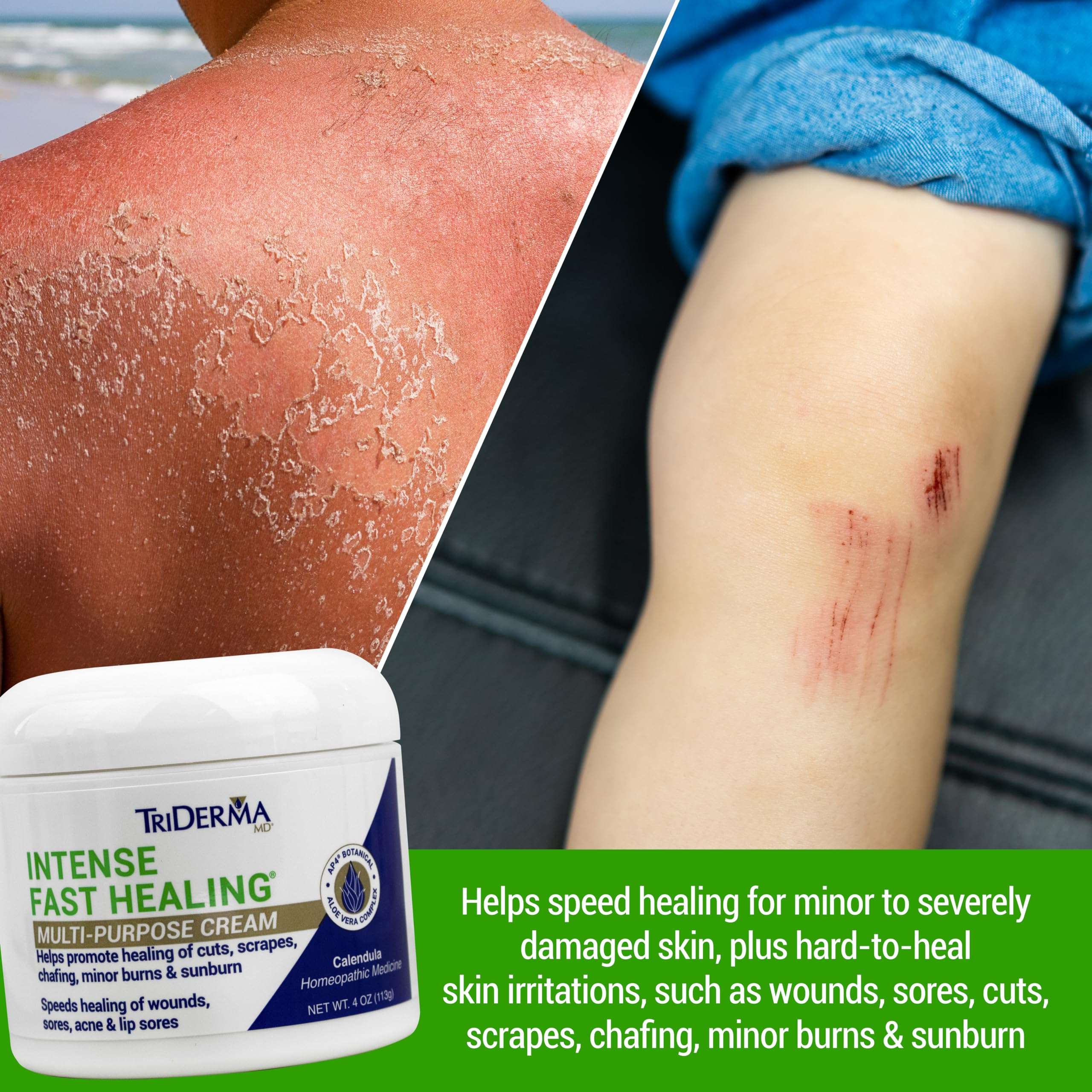 TriDerma Intense Fast Healing Cream, Decreases Healing Time for Minor Irritations, Rashes, Scrapes, Cuts 4 Ounces 3